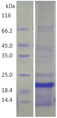 15% SDS-PAGE analysis profiles of purified AB57_1059-58-177 (CBB stained).